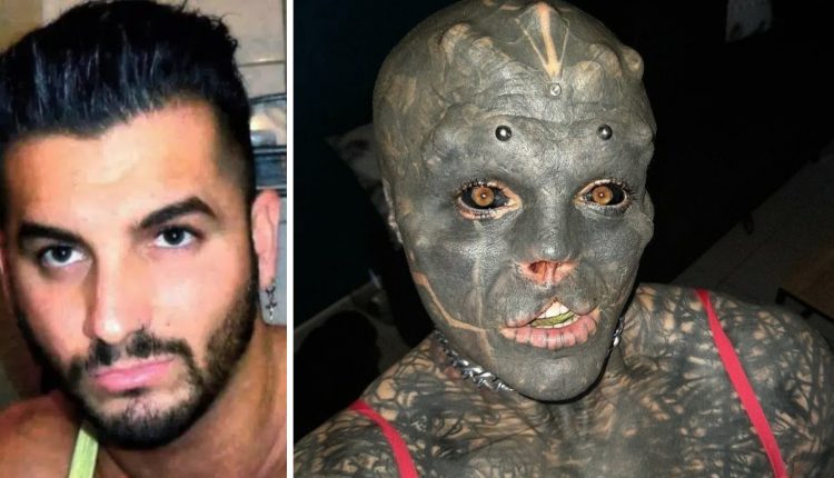 Anthony Loffredo, un Français de 32 ans s’est fait enlever le nez et la lèvre supérieure afin de ressembler à un extraterrestre.